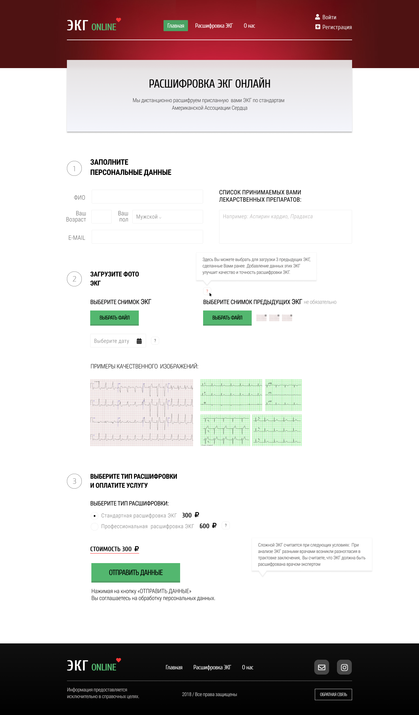 ЭКГ онлайн.png