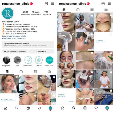 Комплексное продвижение аккаунта клиники косметологии