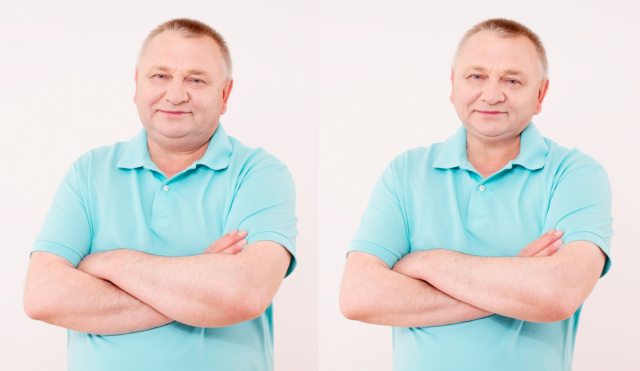 пластика