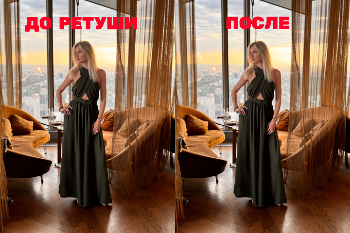 Исправление пластики лица