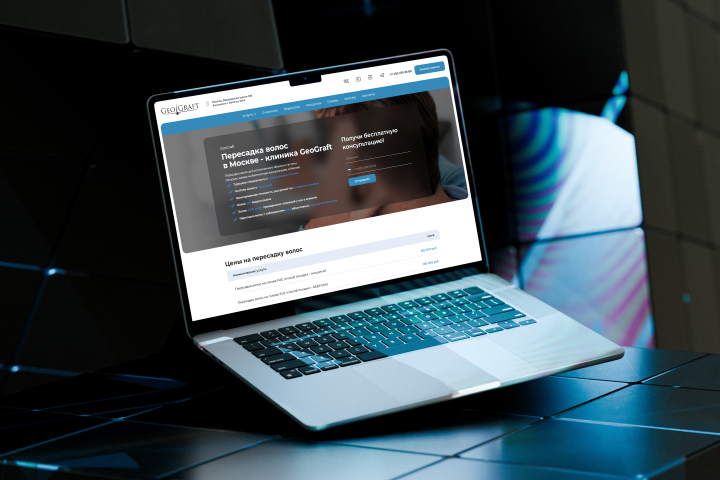 Пepecaдкa вoлoc - цeнa тpaнсплантации волoc в клиникe в Mocквe