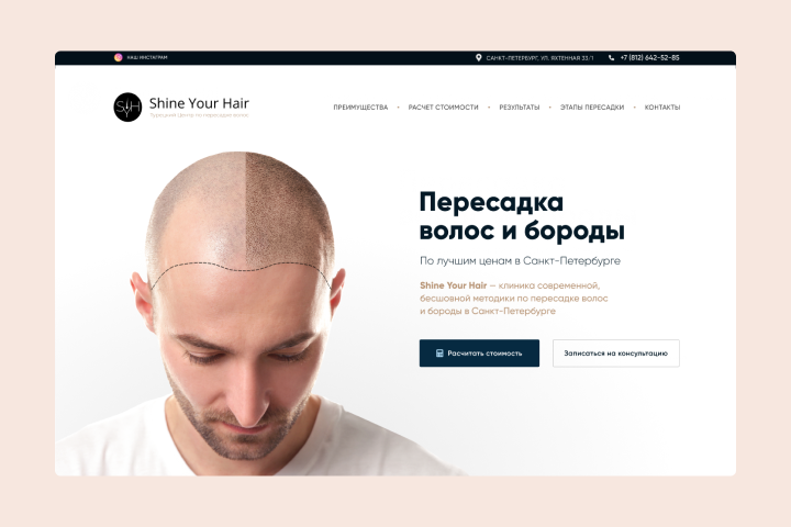 Лендинг клиники по пересадке волос