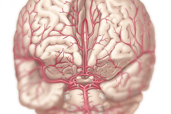 Мед плакат Артерии мозга