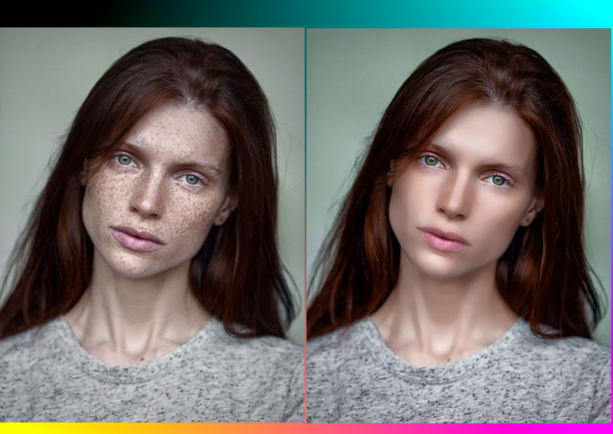 РЕТУШЬ.УДАЛЕНИЕ ВЕСНУШЕК.