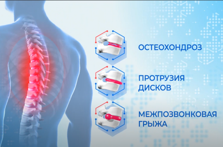 Видеореклама для Доктор Нобель