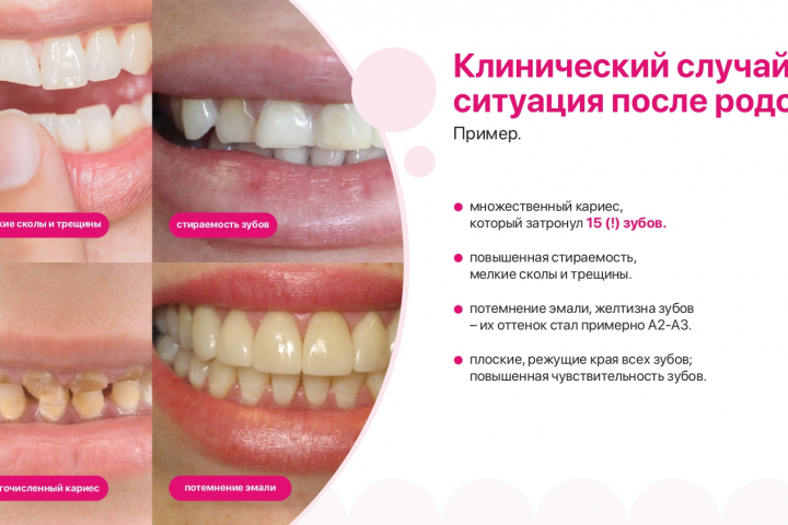 Презентация