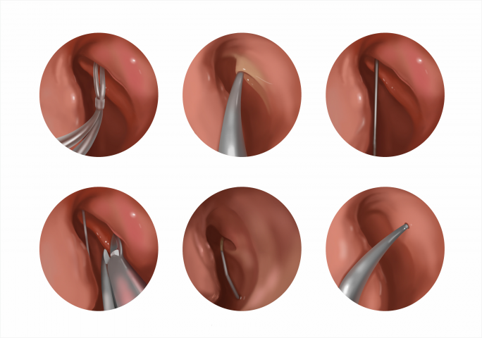 Мед. пособие