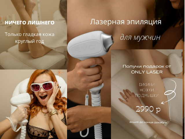 Лазерная эпиляция