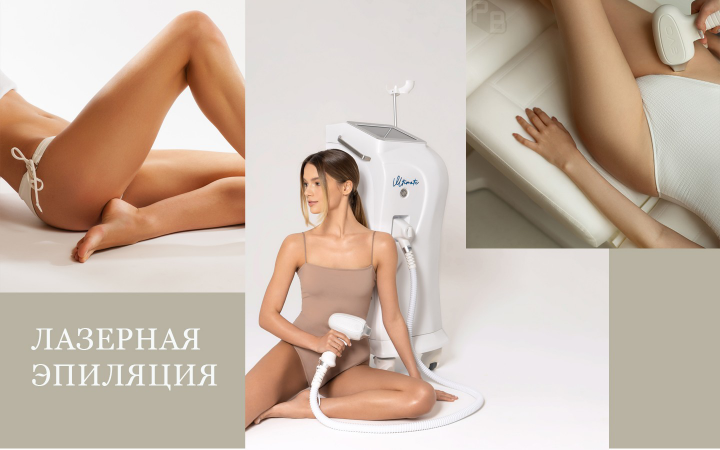 Лазерная эпиляция