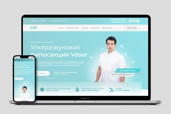Липосакция