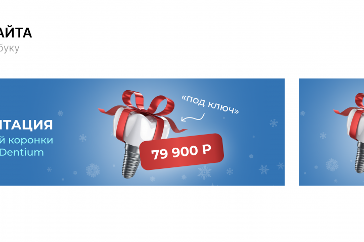 Баннер для сайта