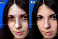 Ретушь/обработка