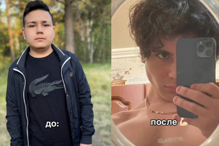 Область - лицо, прическа (безоперационно)