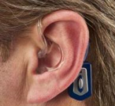 Слуховые аппараты