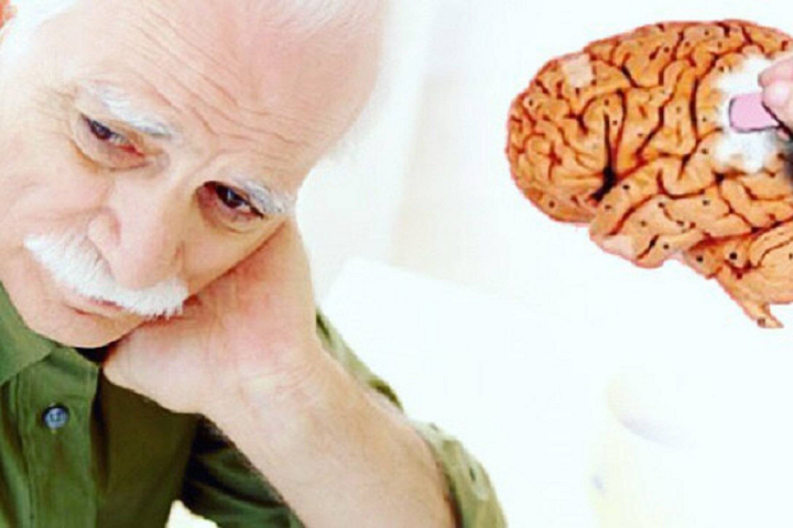 Когнитивные нарушения