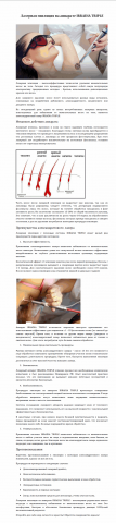 Лазерная эпиляция на аппарате IRRADIA TRIPLE
