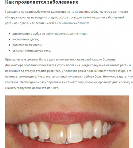Симптомы и лечение гранулемы зуба