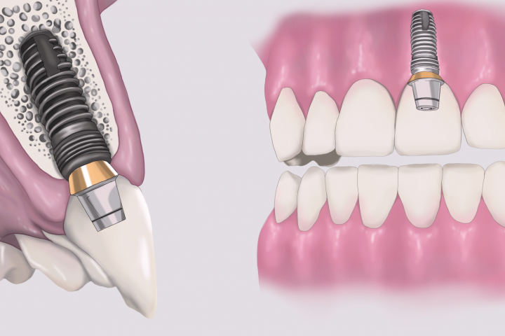 Рисунок для стоматологии