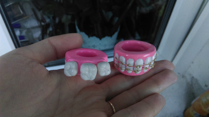 Сувенирные кольца в подарок стоматологу