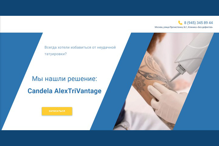 Удаление татуировок лазером