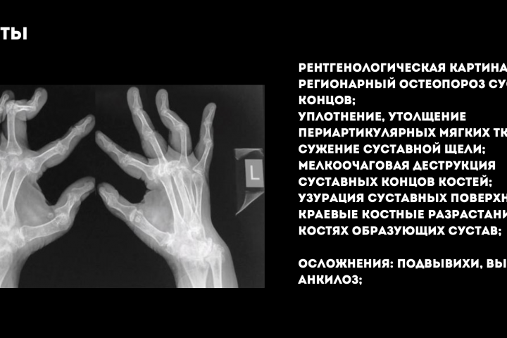 Презентация по Лучевой диагностики