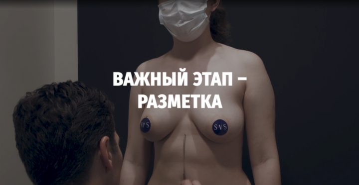 Съемка для эстетической хирурги 2021