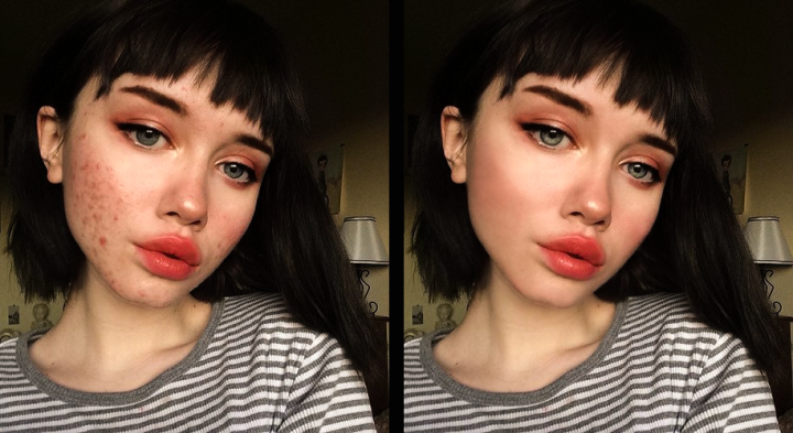 Чистка лица (Хейли Уайт)