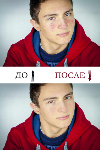 Ретушь