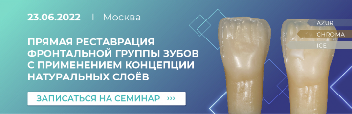 Баннер на сайт