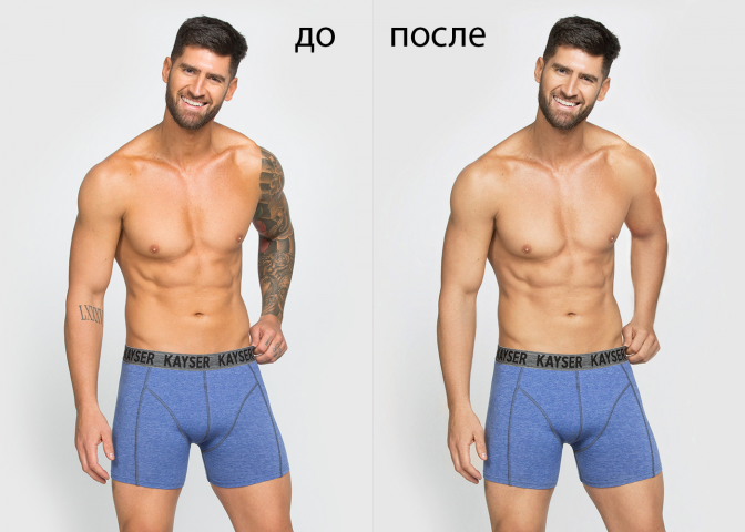 стирание татуировок