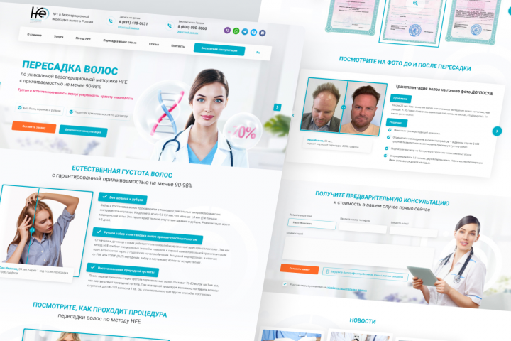 Клиника по пересадке волос