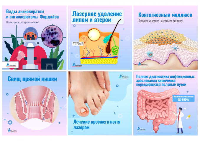 ОФОРМЛЕНИЕ ИНСТАГРАМ СТРАНИЦЫ КЛИНИКИ