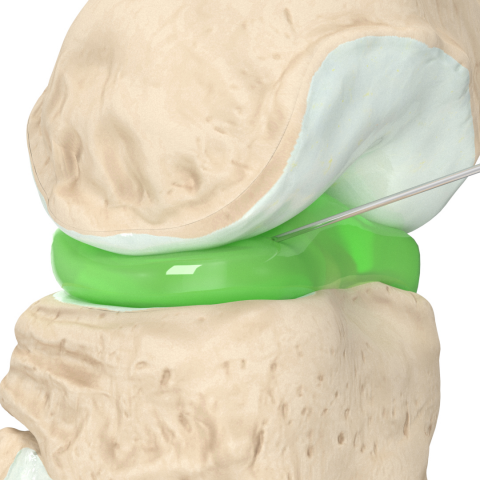 Коленный сустав