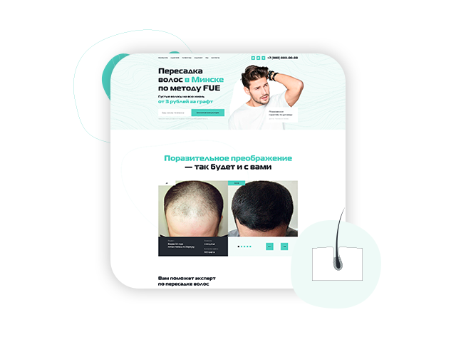 Landing Page клиники пересадки волос