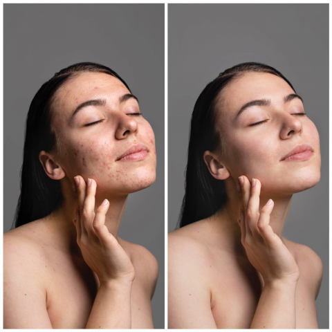 Восстановление