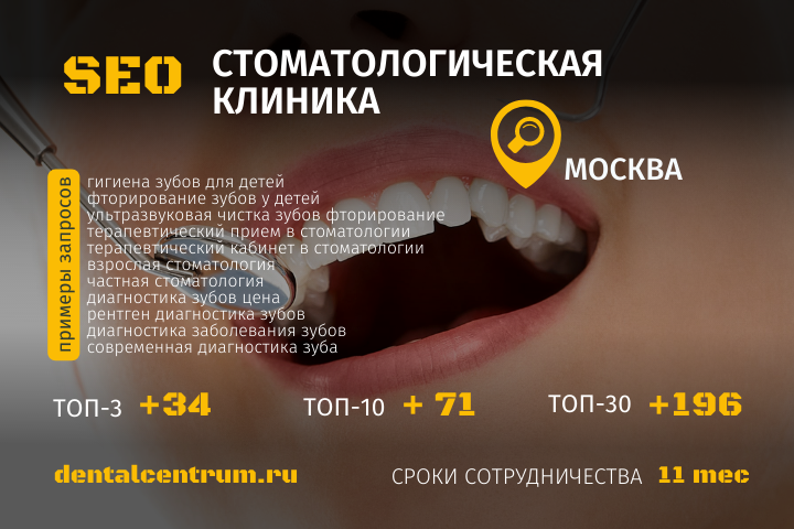 SEO Стоматологическая клиника
