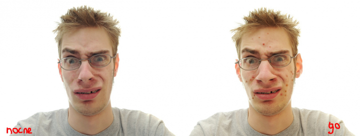 Удаление "желтизны" на фото. Удаление "дефектов"