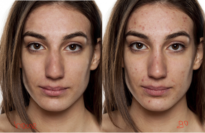 Удаление " дефектов"