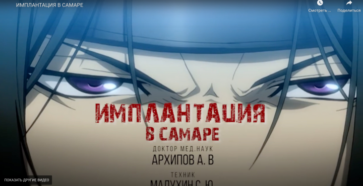 имплантация