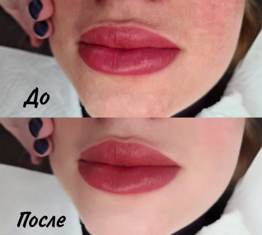 Ретушь лица