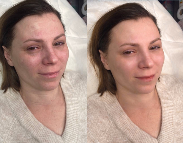 Ретушь лица