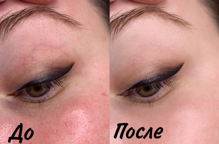 Ретушь лица