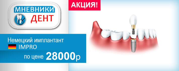 БАННЕР | Акция