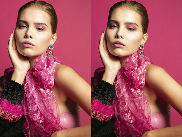 Бьюти ретушь кожи | Пластика