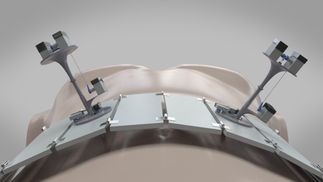 Nexus. Робот хирург