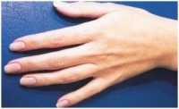 Natural Nail Care System