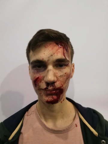 Грим раненного человека