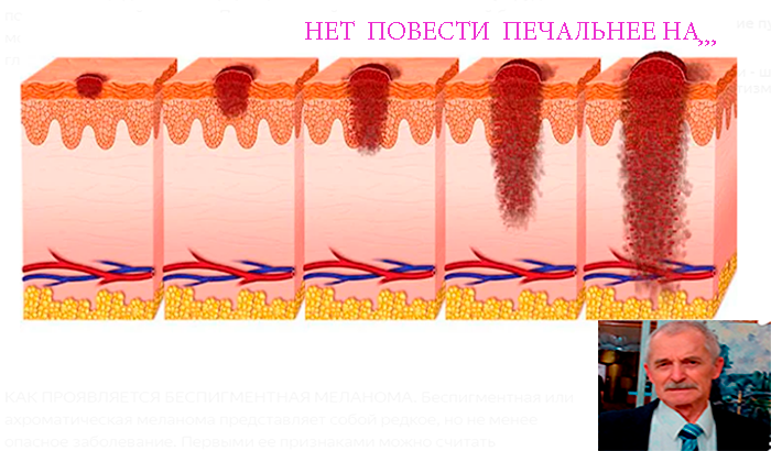 Нет повести печальнее на свете..
