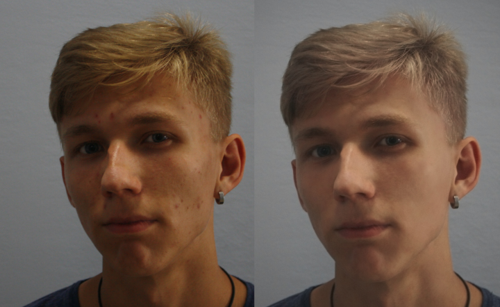 Ретушь фотографии