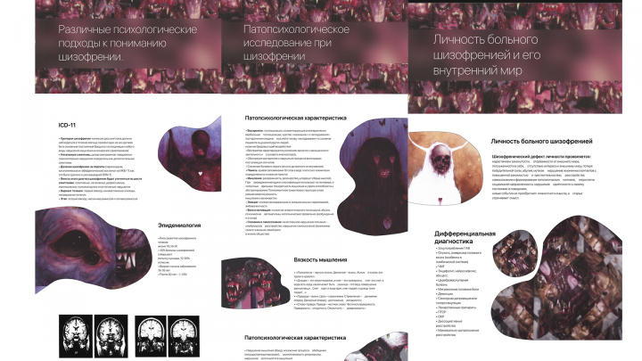 Шизофрения